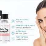 Tag Away Pro Skin Tag Remover Review