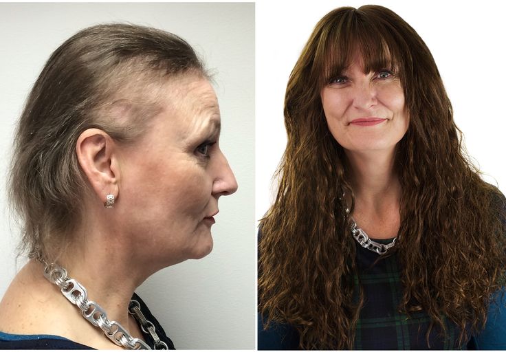 My Experience Using HaloGrow Hair Spray